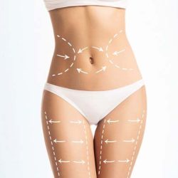 LIPOSUCCION DE PAPADA Y ABDOMEN